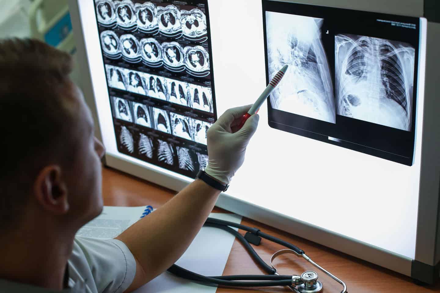 doctor reviewing x-rays